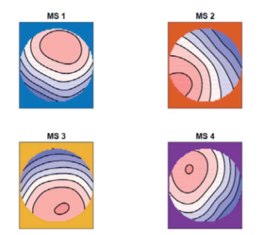 The mean of the topographic maps in the
epileptic group for four microstates (MS 1, MS 2, MS 3,
MS 4).