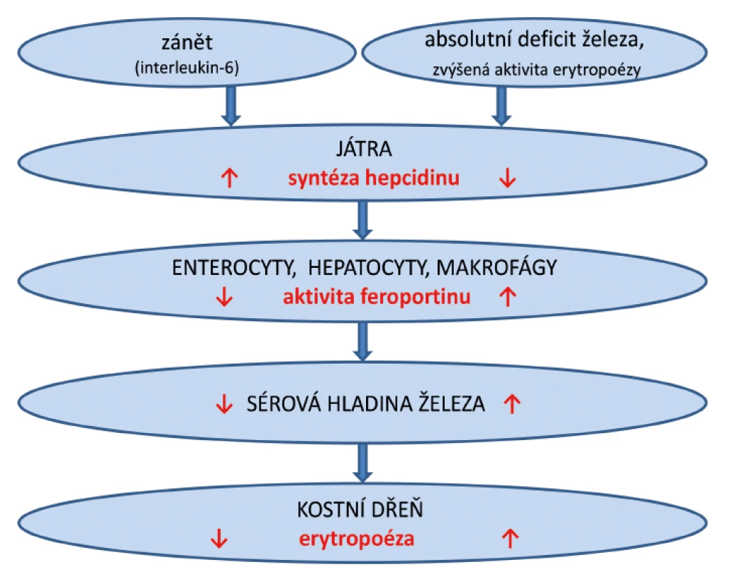 Zjednodušené schéma syntézy hepcidinu a jeho působení na feroportin během zánětu a při deficitu železa.