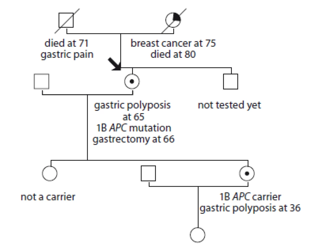 Pedigree of family no. 6 (Masaryk Memorial Cancer Institute).