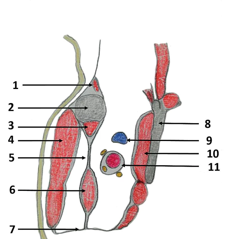 Horizontální řez axilou<br>
1 – žebro, 2 – m. serratus ant., 3 – m. subscapularis, 4 – lopatka,<br>
5 – humerus, 6 – m. psoas major, 7 – m. psoas minor,<br>
8 – společná pochva axilární arterie a brachiálního plexu