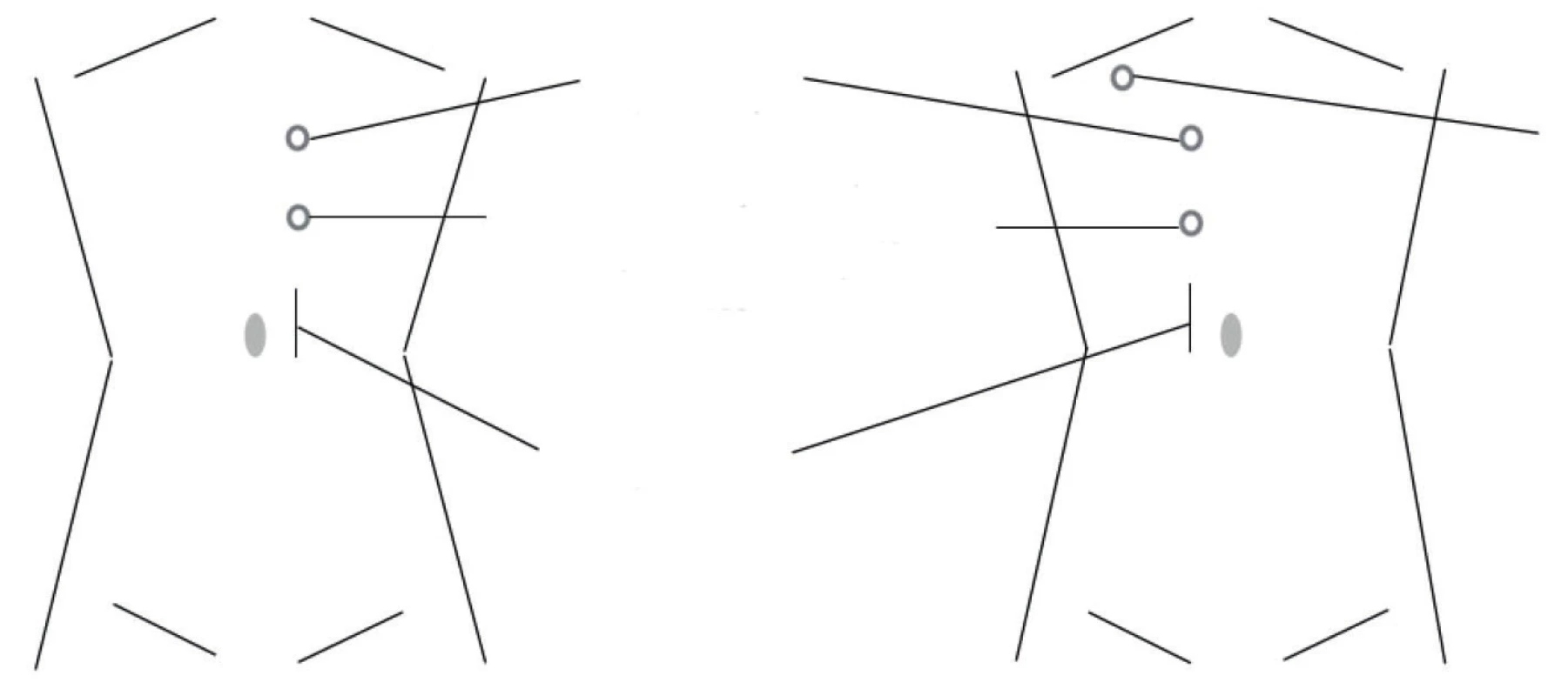 Rozmístění portů pro levou a pravou stranu<br>
Fig. 1. Position of ports for left and right side