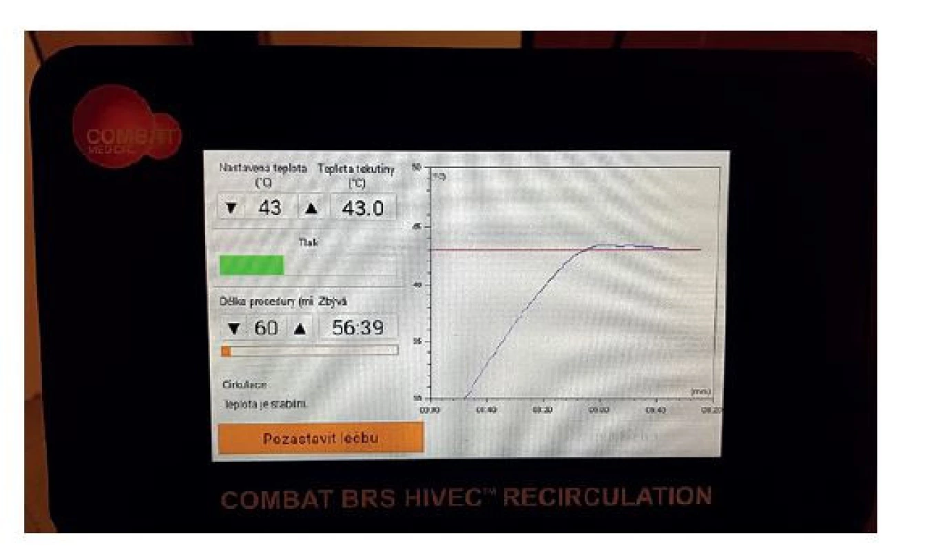 Ovládací rozhraní systému Combat BRS V5<br>
(Foto archiv autora)<br>
Fig. 3: Interface of the Combat BRS V5 system<br>
(Photo: Author‘s archive)