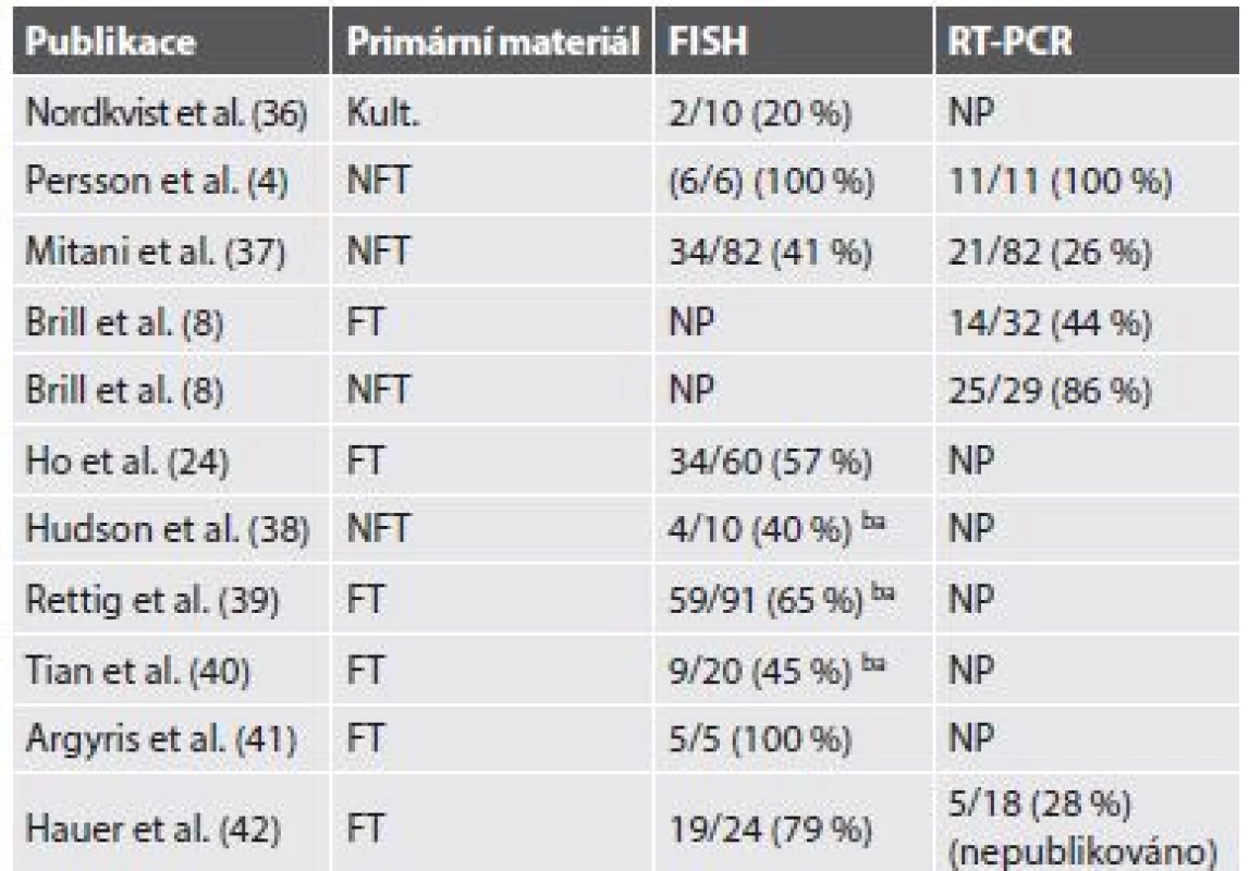 Počty detekovaných fúzí <i>MYB-NFIB</i> v různých studiích použitím
FISH a/nebo pomocí RT-PCR.
