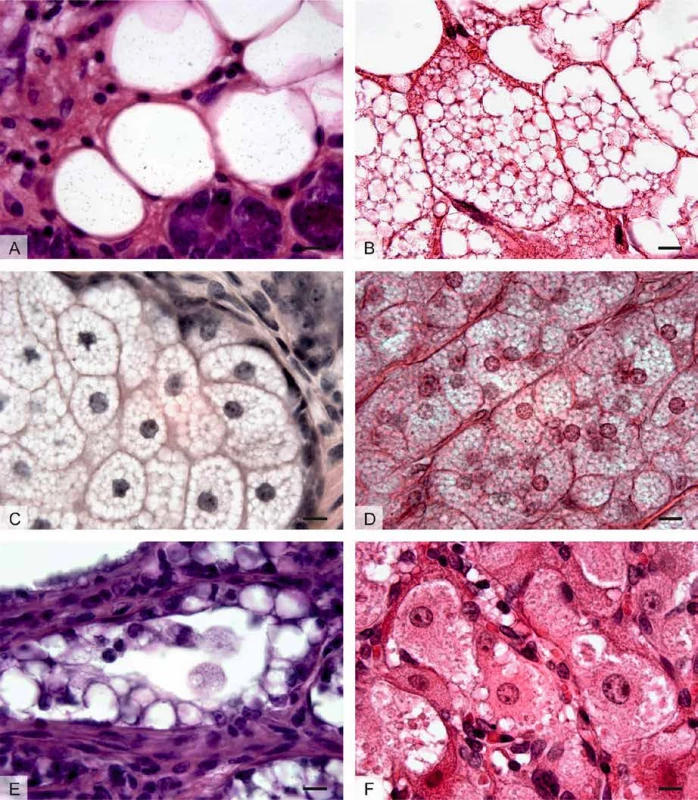Tukové kapénky v různých buněčných typech: