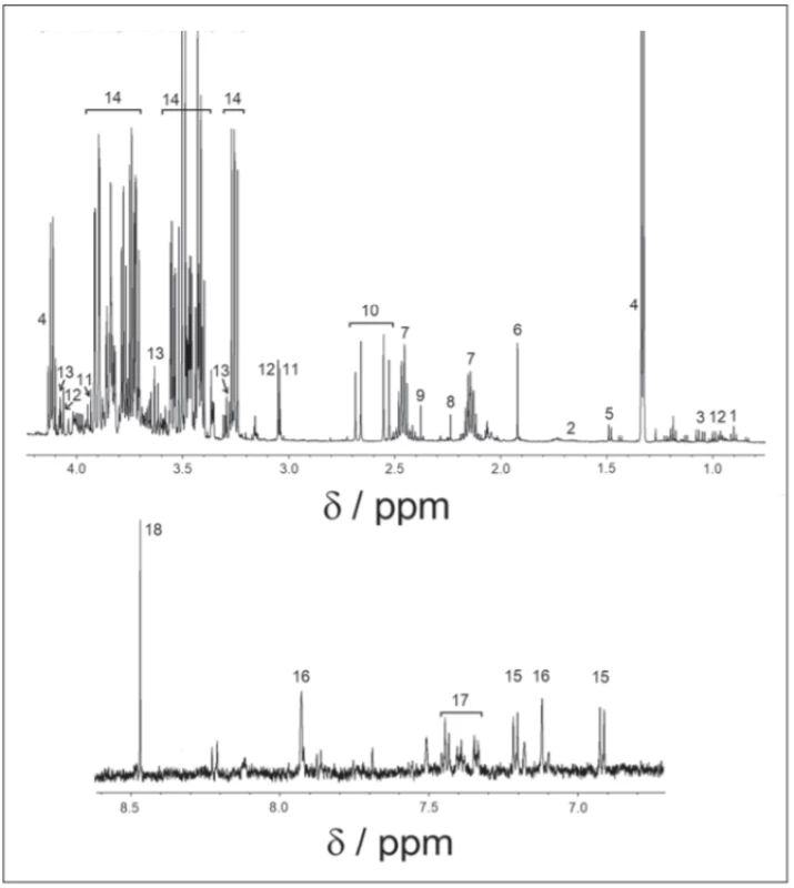 1H-NMR spectrum of cerebrospinal fl uid, cpmg acquisition.
1 – isoleucine; 2 – leucine; 3 – valine; 4 – lactate; 5 – alanine; 6 – acetate; 7 – glutamine;
8 – acetone; 9 – pyruvate; 10 – citrate; 11 – creatine; 12 – creatinine; 13 – myo-inositol;
14 – glucose; 15 – tyrosine; 16 – histidine; 17 – phenylalanine; 18 – formate<br>
Obr. 1. 1H-NMR spektrum v cerebrospinálnom likvore, nábor v pulzovej sekvencii 1H-NMR.
1 – izoleucín; 2 – leucín; 3 – valín; 4 – laktát; 5 – alanín; 6 – acetát; 7 – glutamín; 8 – acetón;
9 – pyruvát; 10 – citrát; 11 – kreatin; 12 – kreatinín; 13 – myo-inozitol; 14 – glukóza; 15 – tyrozín; 16 – histidín; 17 – fenylalanín; 18 – formát