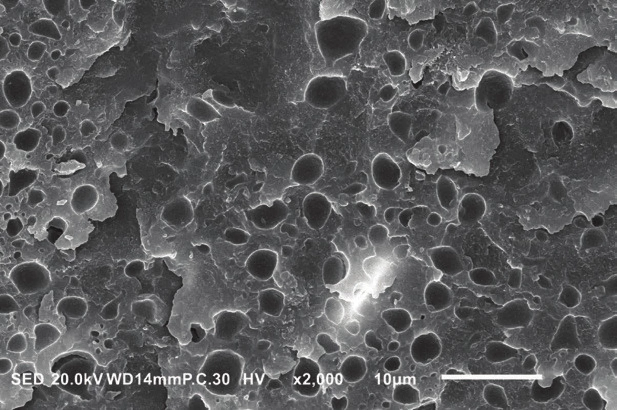 Phase separation observed in the adhesive layer of the HEMA-free universal adhesive G-Premio Bond (GC, Tokyo, Japan). The round-shaped voids were formed by water droplets separated from hydrophobic methacrylates.
Scanning electron microscope, magnification 2000×.
