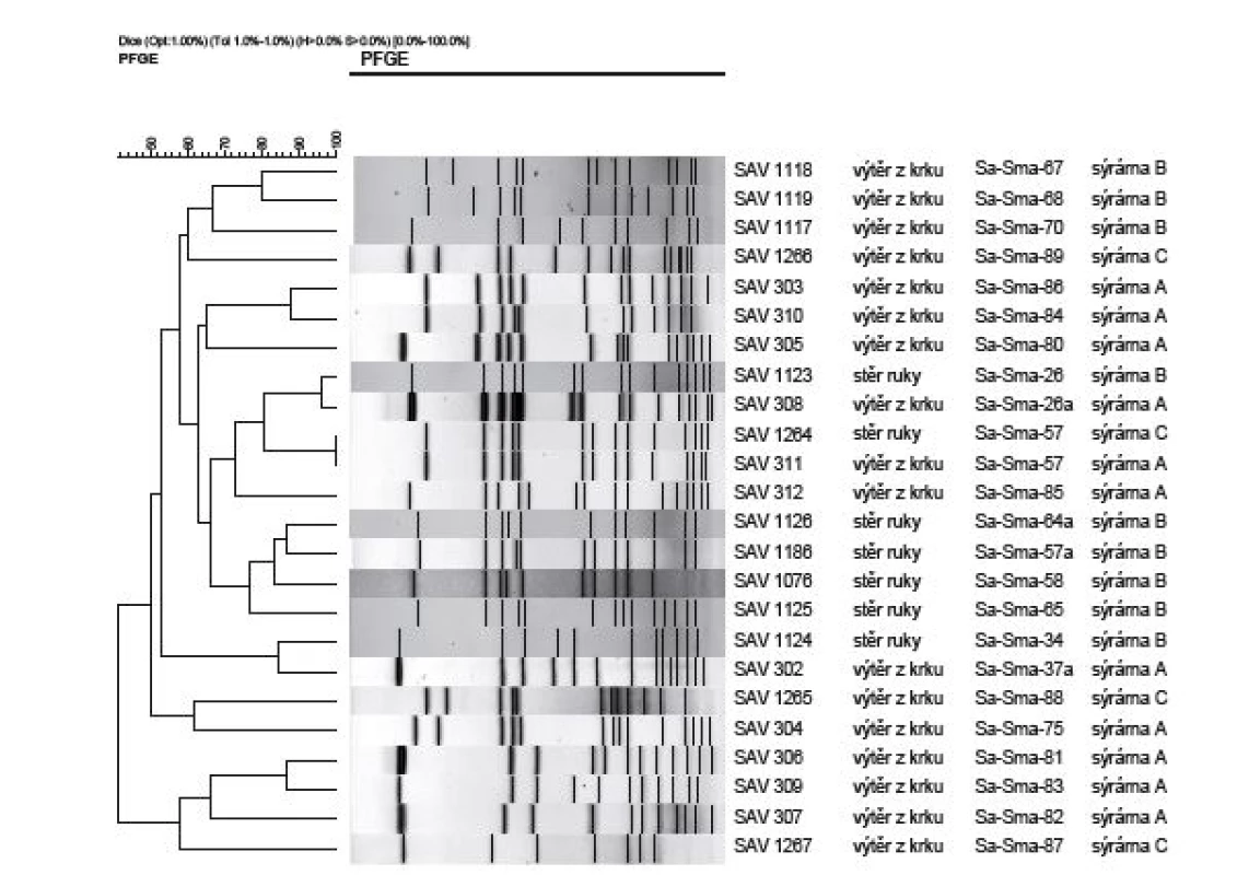 Výsledky pulzní gelové elektroforézy po štěpení endonukleázou SmaI u kmenů <i>Staphylococcus aureus</i> izolovaných od pracovníků
sýráren<br>
Figure 1. Results of analysis of <i>Staphylococcus aureus</i> isolates from cheese factory staff by pulsed field gel electrophoresis after digestion
with restriction endonuclease SmaI