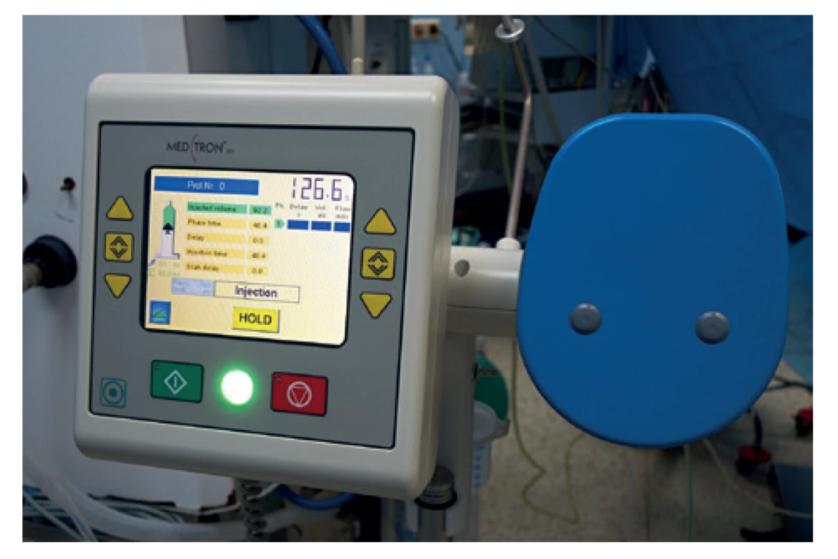 Displej vysokotlaké pumpy<br>
Fig. 5: Display of the high pressure pump