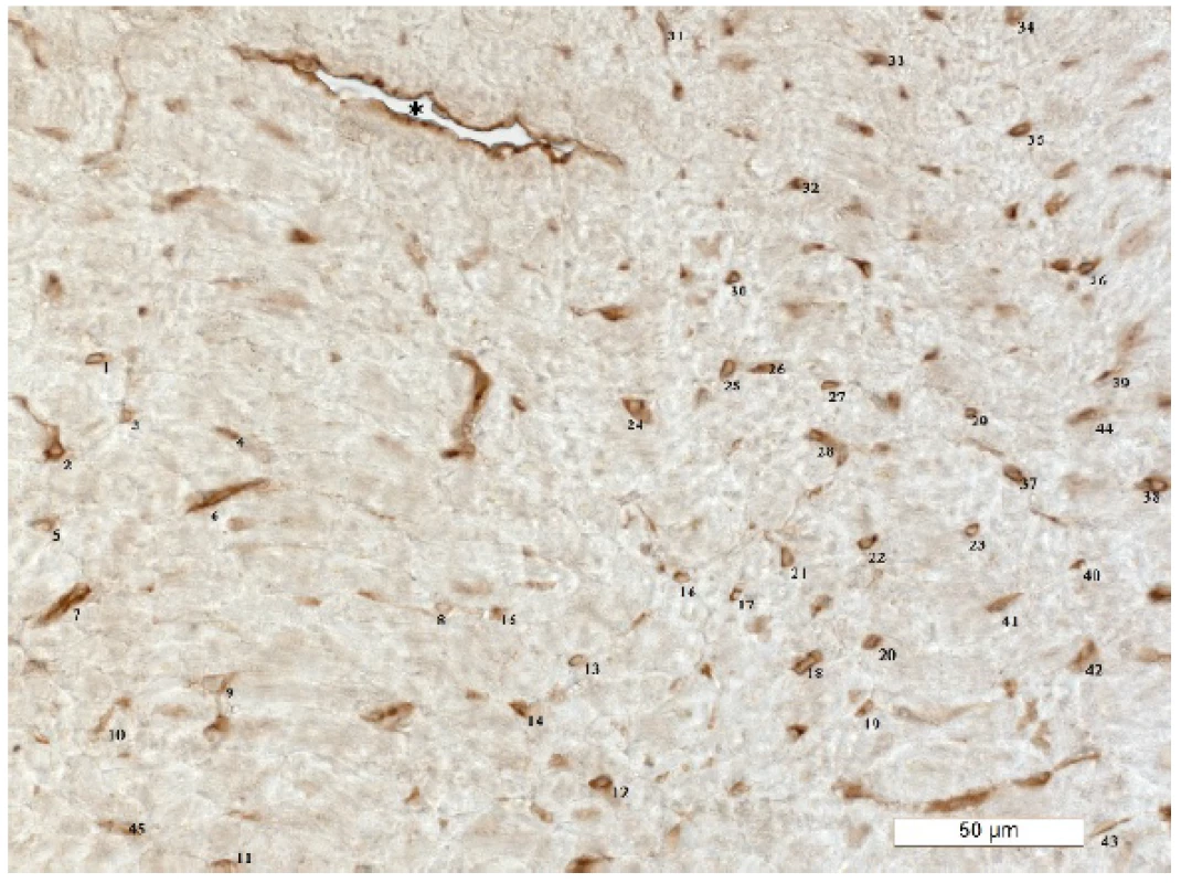 The result of immunostaining (anti-CD31) and manual counting of capillaries perpendicular to the plane of section of myocardium (numbers). Note that only microvessels, i.e., precapillary arterioles, capil-laries, and postcapillary arterioles, were taken into account. Bigger vessels(*) were omitted. Scale is inserted.