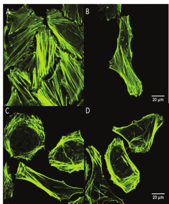 The changes in the cytoskeletal actin structure of
the (A, B) HeLa control cells and (C,D) HeLa cells
exposed to the 5 Jcm-2 ZnPc PDT, evaluation using
fluorescent confocal microscopy. The cells were stained
by Alexa Fluor 532 phalloidin fluorescence probe. The
images showed that 5 Jcm-2 ZnPc PDT on HeLa cells led
to extensive cytoskeletal actin rearrangement and/or its
impairment.