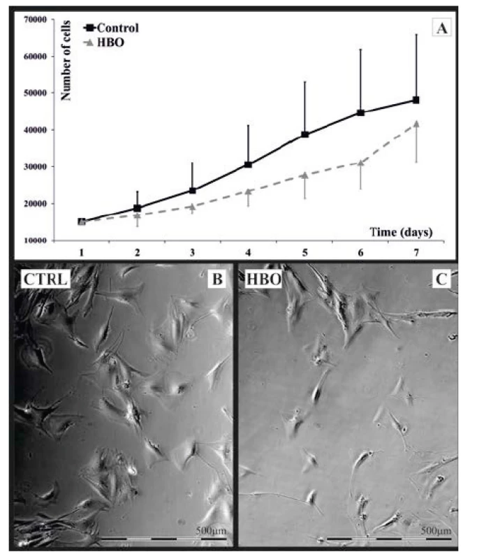A-C. Hodnocení změn buněčné morfologie HFL1<br>
A – rychlost růstu vyjádřená počtem buněk na 1 ml se mezi kontrolní
a HBO fibroblasty nelišila<br>
B, C – HFL1 ve fázovém kontrastu při zvětšení 60krát