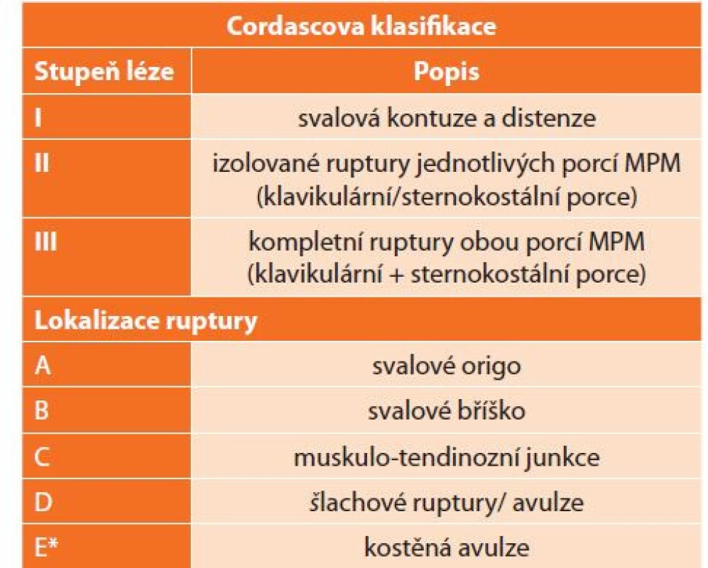 Cordascova klasifikace poranění m. pectoralis major,
převzato z [22]<br>
Tab. 1: Cordasco classification of pectoralis major injuries,
reprinted from [22]