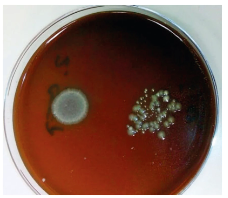 Vzorek slizu kultivovaný 24 hodin na Columbia krevním
agaru<br>
Sliz – neředěný a ředěný (na snímku vpravo) – je kontaminován
půdní bakteriální mikrobiotou.<br>
Figure 2. Slime sample cultured for 24 hours on Columbia blood
agar<br>
Slime – undiluted and diluted (pictured on the right) – is
contaminated by soil bacterial microbiota.
