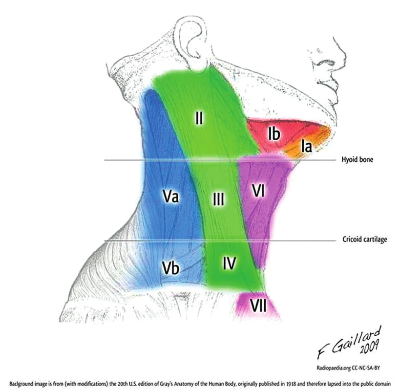 Priestory krku a horného mediastína, anatomicko-
-klinické oblasti I-VII (Case courtesy of A. Prof Frank Gaillard,
Radiopaedia. org).