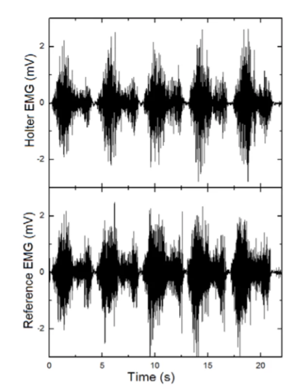 EMG =f(t) - Holter signal comparison with
reference device Neuro-MEP.