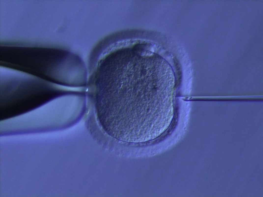 Vpich spermie do oocytu při ICSI, vpravo těsně u hrotu jehly je vidět spermie