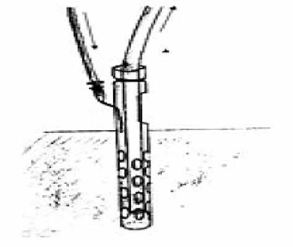 Modifikovaný srkavý drén (vlastný archív)<br>
Fig. 3: Modified sump drain (custom archive)