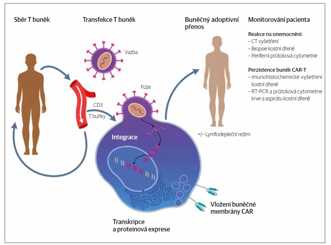 Schéma přípravy a aplikace CAR-T buněk.