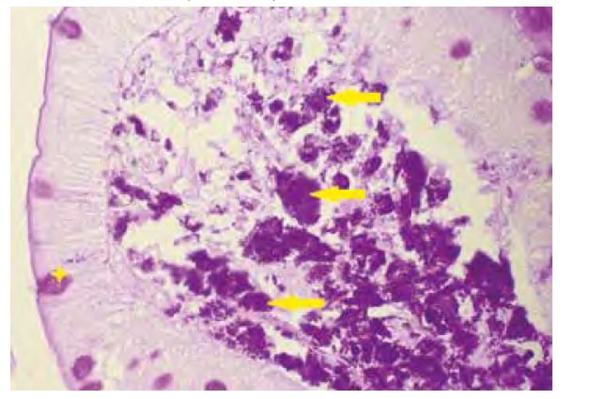 Detail duodenální sliznice v barvení PAS (hvězdička označuje
pohárkovou buňku, šipky makrofágy)