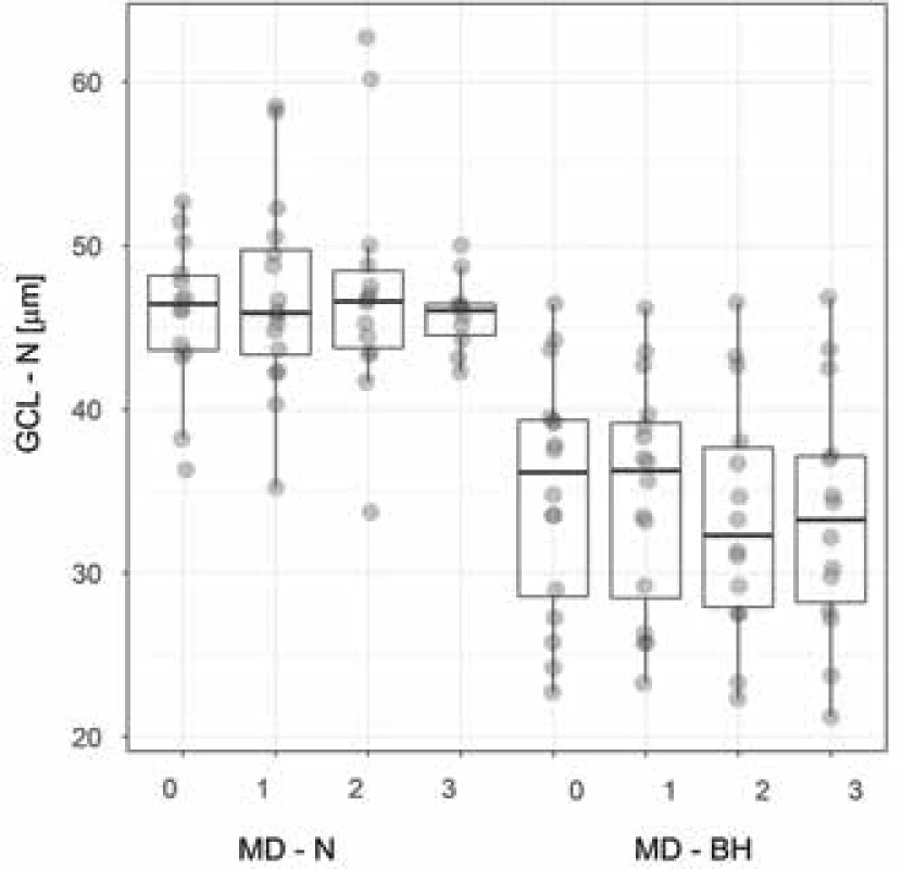 Thickness of nasal layer of GCL in patients with and
respectively without bitemporal hemianopia. The box plot
indicates the median, lower, upper quartile and maximum/
minimum values, though no more than 1.5 of the interquartile
range. The values are spaced so as to show the quantity
of overlapping values.
Abbreviations – GCL – N – nasal ganglion cell layer, MD – N,
respectively BH – mean deviation of visual field in patients
with and respectively without bitemporal hemianopia, 0 –
preoperative examination, 1, 2, 3 – first, second and third
postoperative follow-up examination