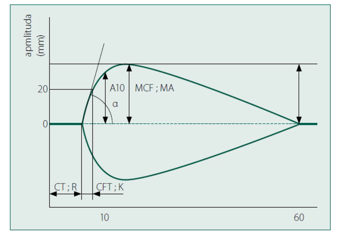 Standardní tromboelasto-metrická (grafická) křivka
apmlituda