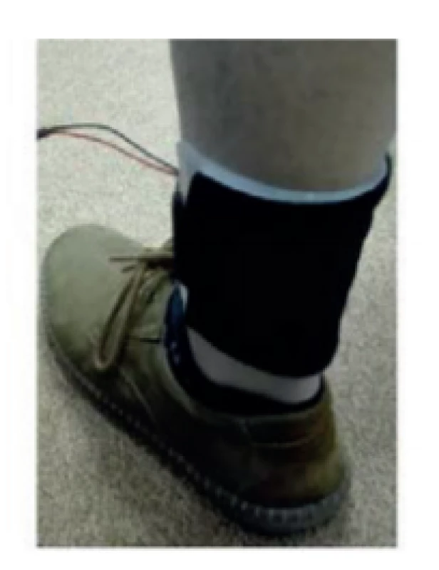 The f-TEG module placed on the ankle