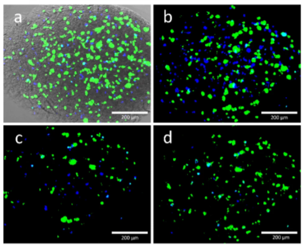  Viable (green) and dead (blue) HEK cells were
found in the printed structure. Each image shows the
same position of a scaffold printed with 50 kPa. Images
were taken at 0 DAP, 3, DAP, 6 DAP and 10 DAP and
they are matching the alphabetic order of the figures.
Image a) was merged with a transmitted light image to
get an impression at the scaffold.