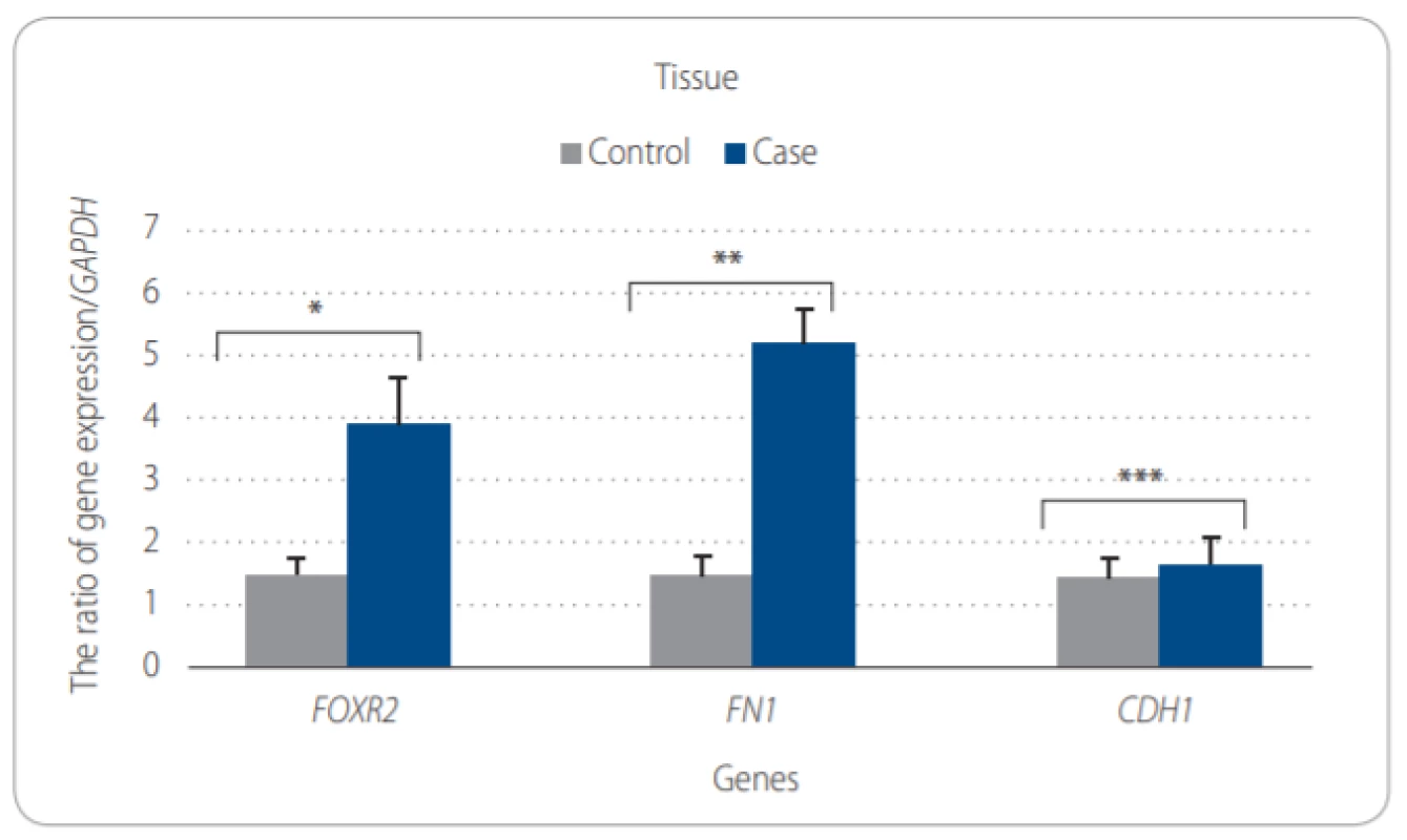 A. Comparison of expression of target genes to GAPDH in epithelial ovarian tissues (EOC) obtained from EOC patients and SKOV-3 cell line by Mann-Whitney test. The
ratio of genes expression of FOXR2, FN1, CDH1 and GAPDH.