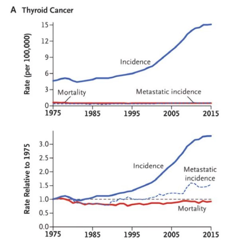 Vývoj incidence a mortality zhoubných nádorů štítné žlázy v letech
1975–2015. Upraveno podle Welsch et al. 2019 (3)