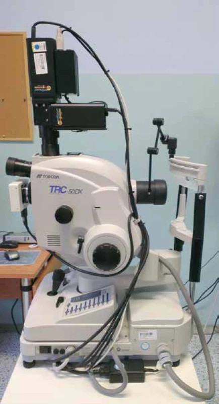  Retinal oximeter Oxymap T1 (black instrument
above) placed on Topcon retinal camera 