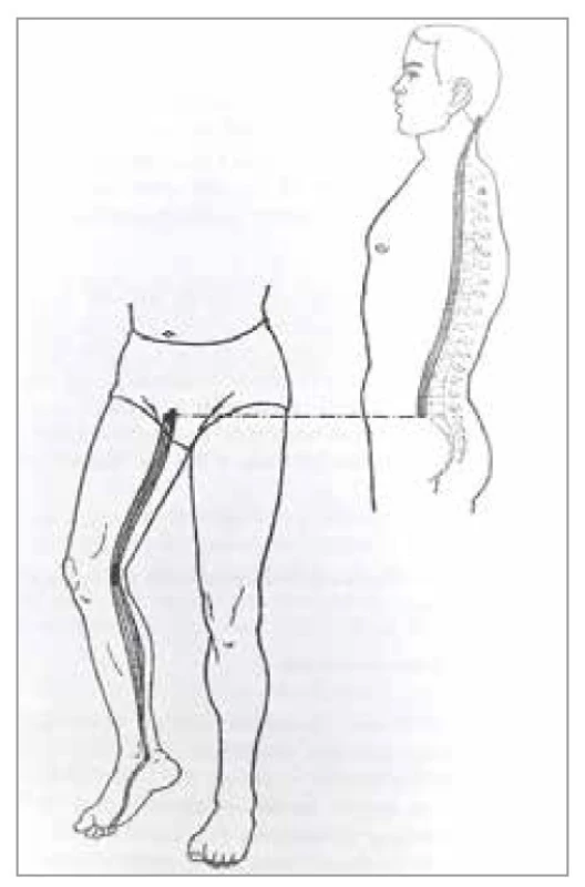 Šľachovo-svalová dráha
obličiek<br>
Fig. 15. Tendon-muscle path of the
kidney