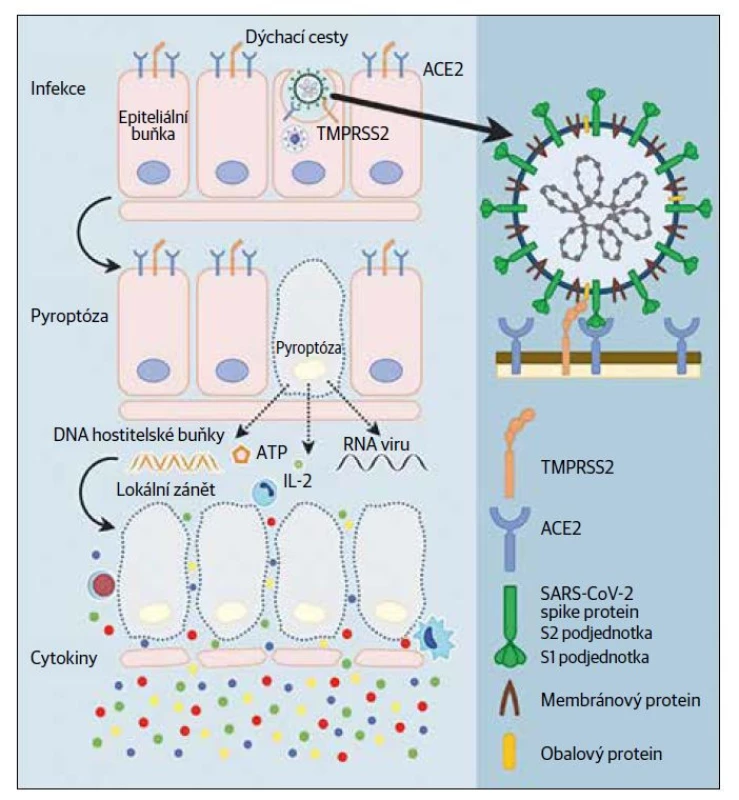 Části koronaviru a vazba na buňku, pyroptóza (inspirováno schématem: Jiang L, Tang K,
Levin M, Irfan O, Morris SK, Wilson K, Klein JD, Bhutta ZA. COVID-19 and multisystem inflammatory
syndrome in children and adolescents. Lancet Infect Dis 2020;20(11):e276–e288).