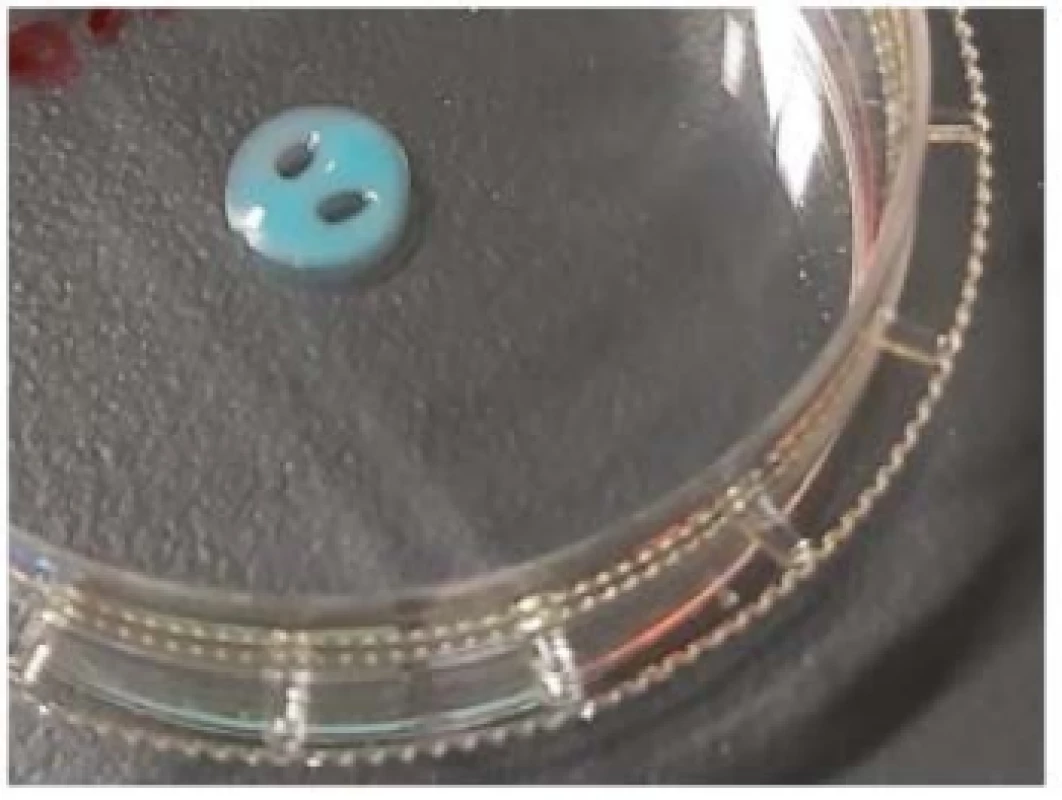 3D printed sensor hydrogel on Ar plasma
activated Petri dish.