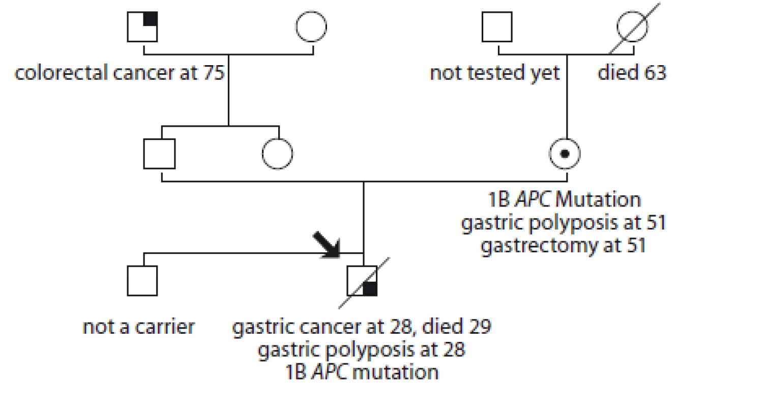 Pedigree of family no. 4 (Masaryk Memorial Cancer Institute).