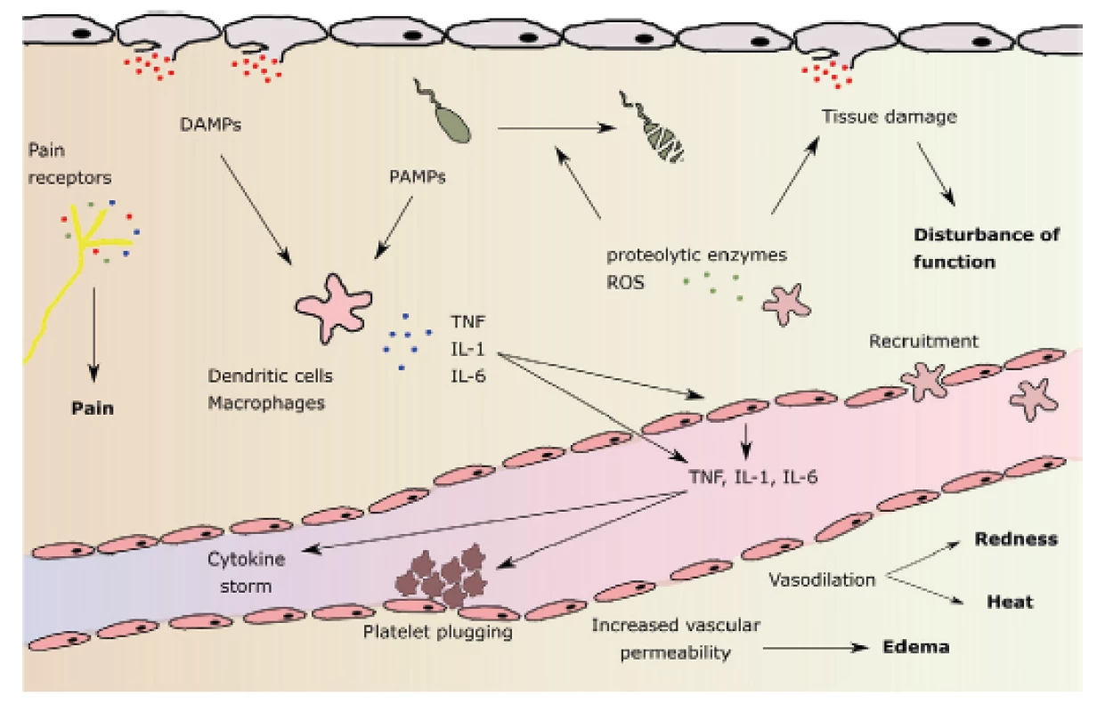 Pathophysiology of local inflammatory reaction and its main
features:
pain, redness, elevated temperature, swelling and malfunction
(in bold). DAMPs: damage-associated molecular patterns;
PAMPs: pathogen-associatied molecular patterns; ROS: reactive oxygen
species.
According to M. L. Varela et al. Inflammation 2018