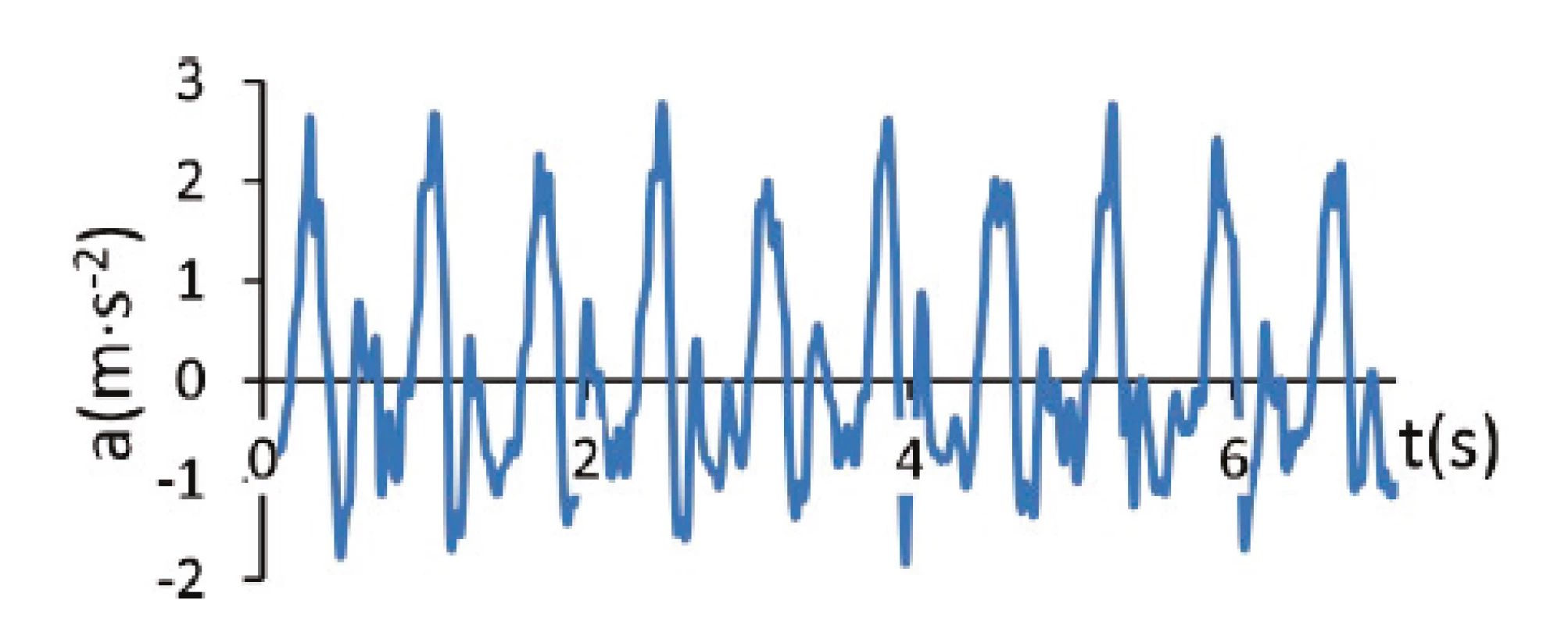 Example of a visualization of the measured magnitude of the acceleration vector in time domain
data during gait. It is a record of a triple axis accelerometer located on an individual’s upper arm.