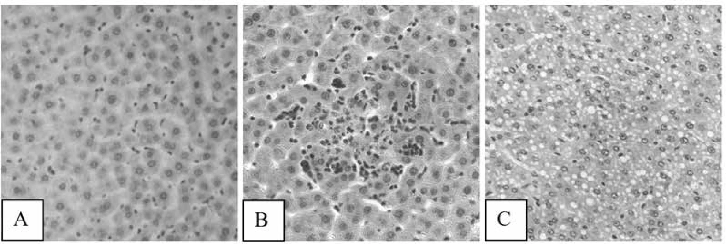 Photomicrographs of samples of liver tissues of intact control rats (A), rats treated with MTX (B,
C): a focus of hepatocyte necrosis (В) (× 250), vacuolar degeneration of hepatocytes (C) (HX&E × 200)