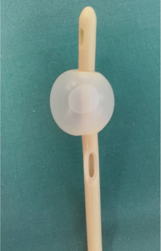 Permanentní močový katétr s arteficiálně
vytvořeným otvorem v úrovni pod balonkem<br>
Fig. 3. Permanent urinary catheter with arteficially
created opening under baloon