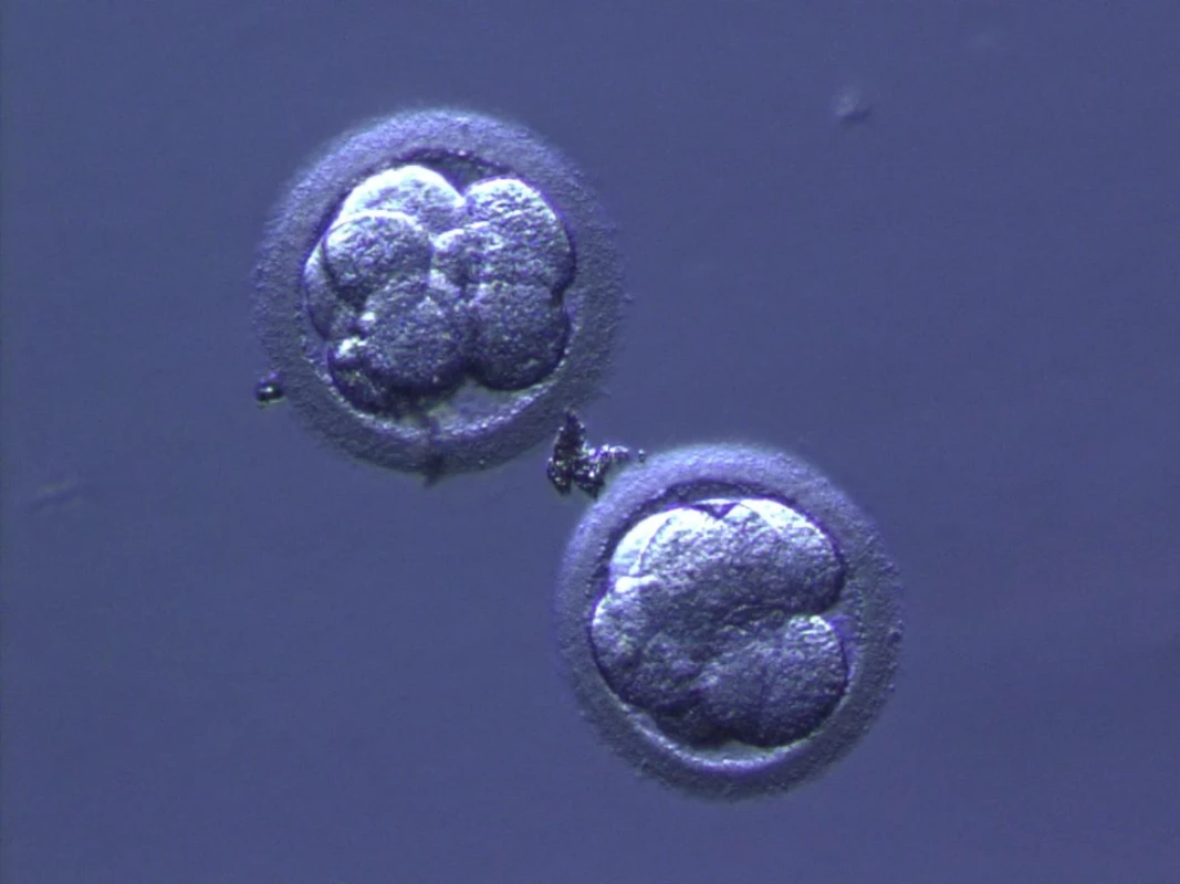 Třídenní embrya (8 buněk)
