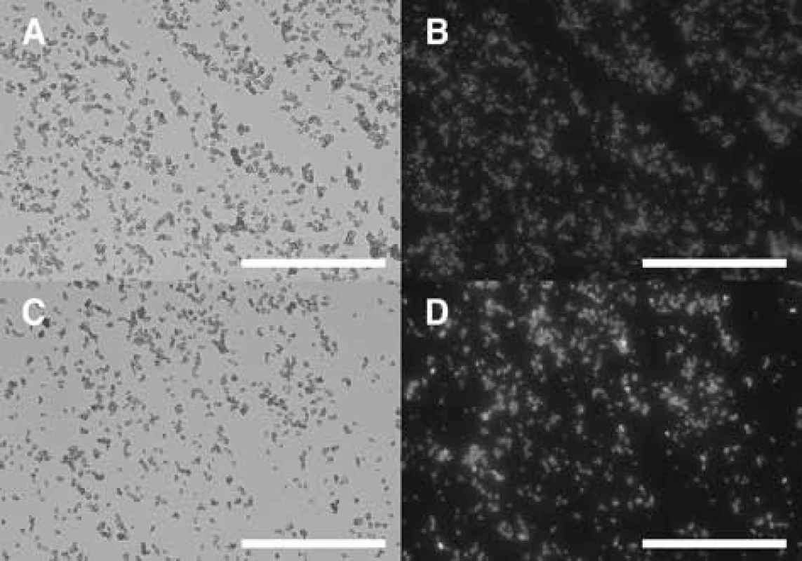 Připravené glukanové částice z pekařských kvasinek S.
cerevisiae – optická mikroskopie<br>
A – čisté glukanové částice v procházejícím světle, B – čisté
glukanové částice ve fluorescenci, C – kompozity glukanových
částic v procházejícím světle, D – kompozity glukanových
částic ve fluorescenci