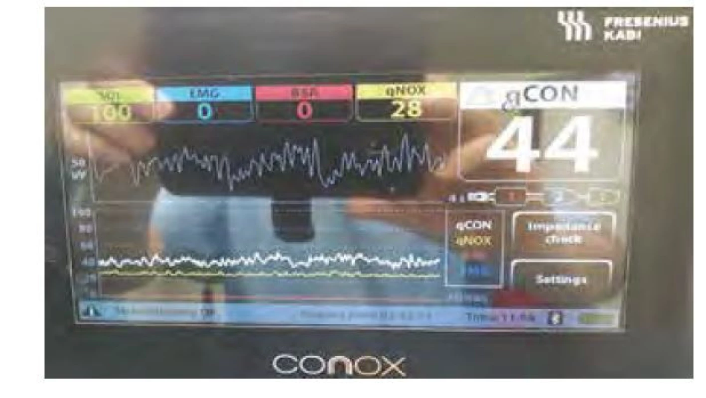 Monitor Conox