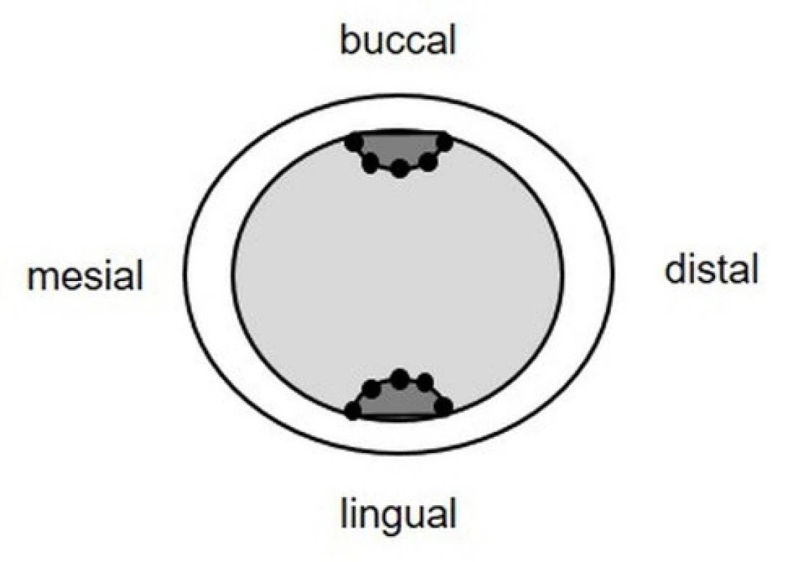 Horizontally cut replica slice. Measuring points (dots) in buccal/lingual grooves and proximal boxes respectively (5 points each)