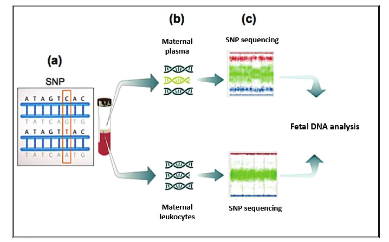 Representative scheme of NIPT for SNP aneuploidies. (a) SNPs are polymorphisms on a single nitrogenous basis; (b) the free DNAs of the maternal plasma, i.e. the fetus and the mother, are sequenced; and separately, only the DNA of the white maternal cells is sequenced; (c) after considering the position of the SNPs in the chromosomes and the possibility of recombination between them, the relative quantitative contribution of the fetal and maternal DNAs is determined by crossing information between the two sequencing, and then the probabilities of the fetuses are calculated euploid, aneuploid or triploid.