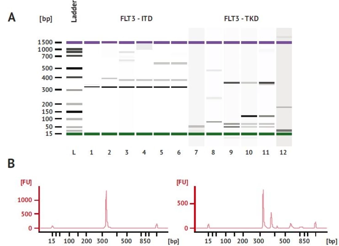 Separácia PCR produktov FLT3-ITD na mikročipe Bioanalyzer 2100.