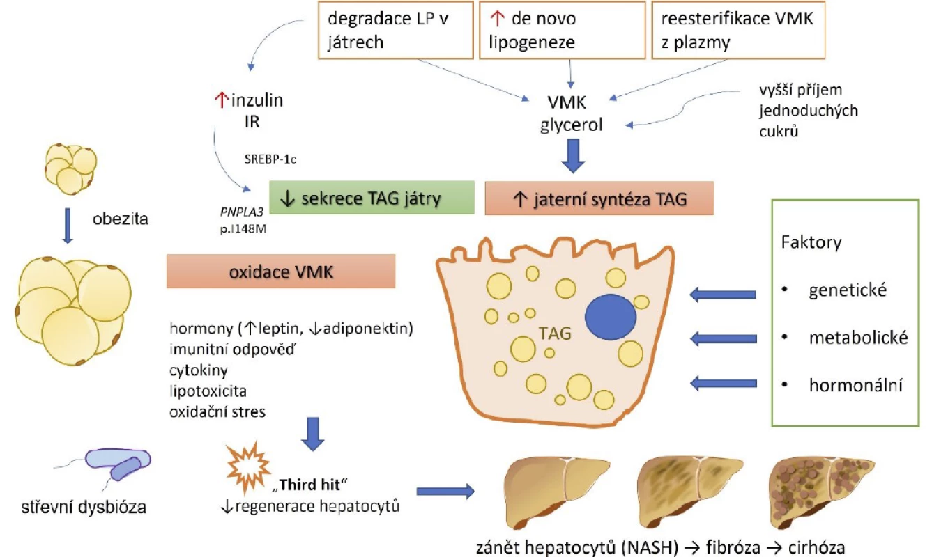Komplexní patogeneze NAFLD při metabolickém syndromu (5)