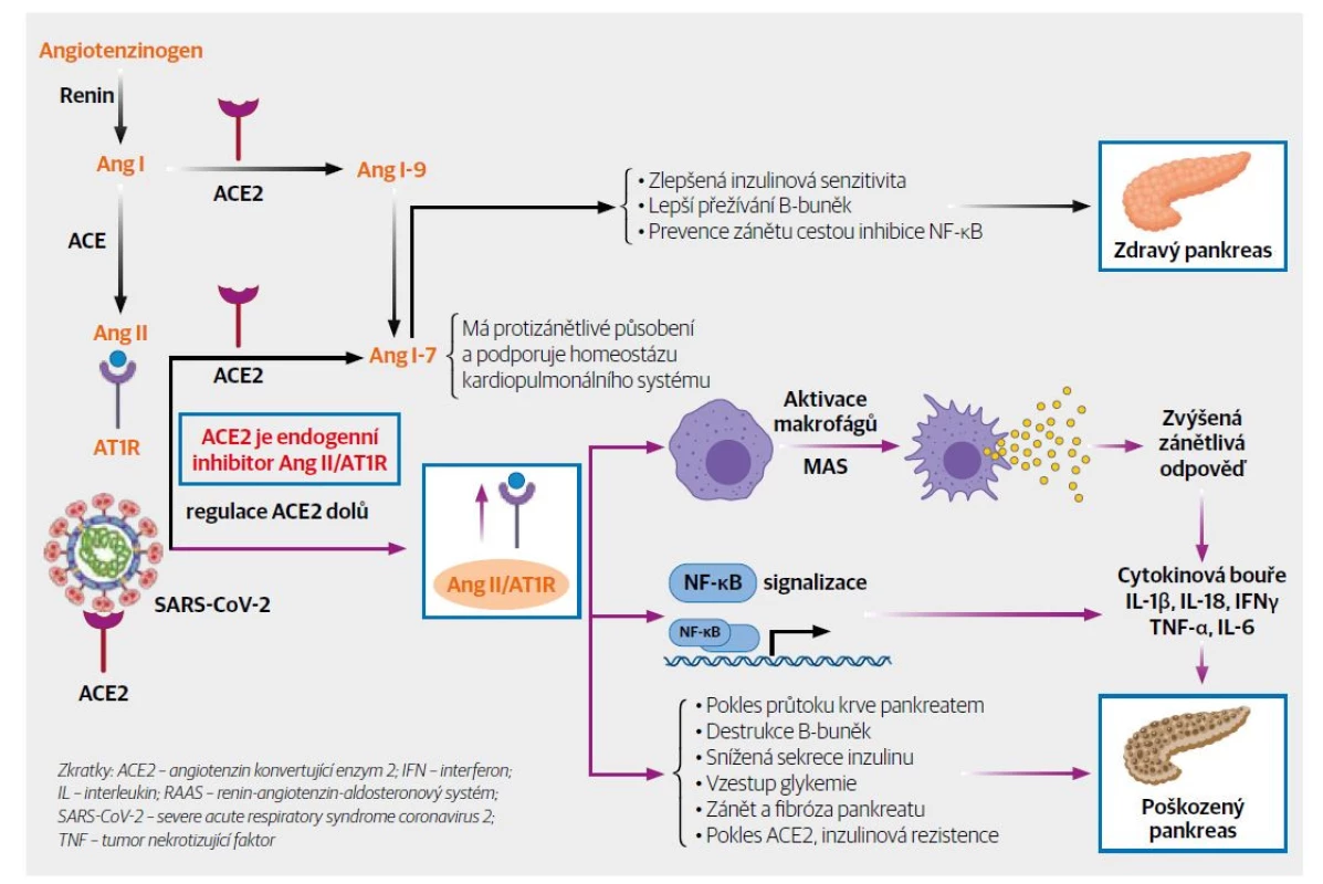 Infekce SARS-CoV-2 a RAAS se změnami ACE2 ovlivňujícími zánětlivou reakci organismu. [Upraveno podle 12]