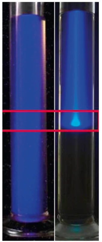 Demonstrace rozdílu mezi rozdělením dávky fotonového
(vlevo) a protonového (vpravo) svazku, experiment za použití
kapalného scintilátoru ukazuje fakt, že protonový svazek ozáří
minimálně tkáň před cílovou oblastí (označeno červeným
ohraničením) a žádnou za ní, kdežto svazek fotonů prozáří celý
objem jak před ní, tak i za ní. V případě pacienta se zde nachází
zdravá tkáň.