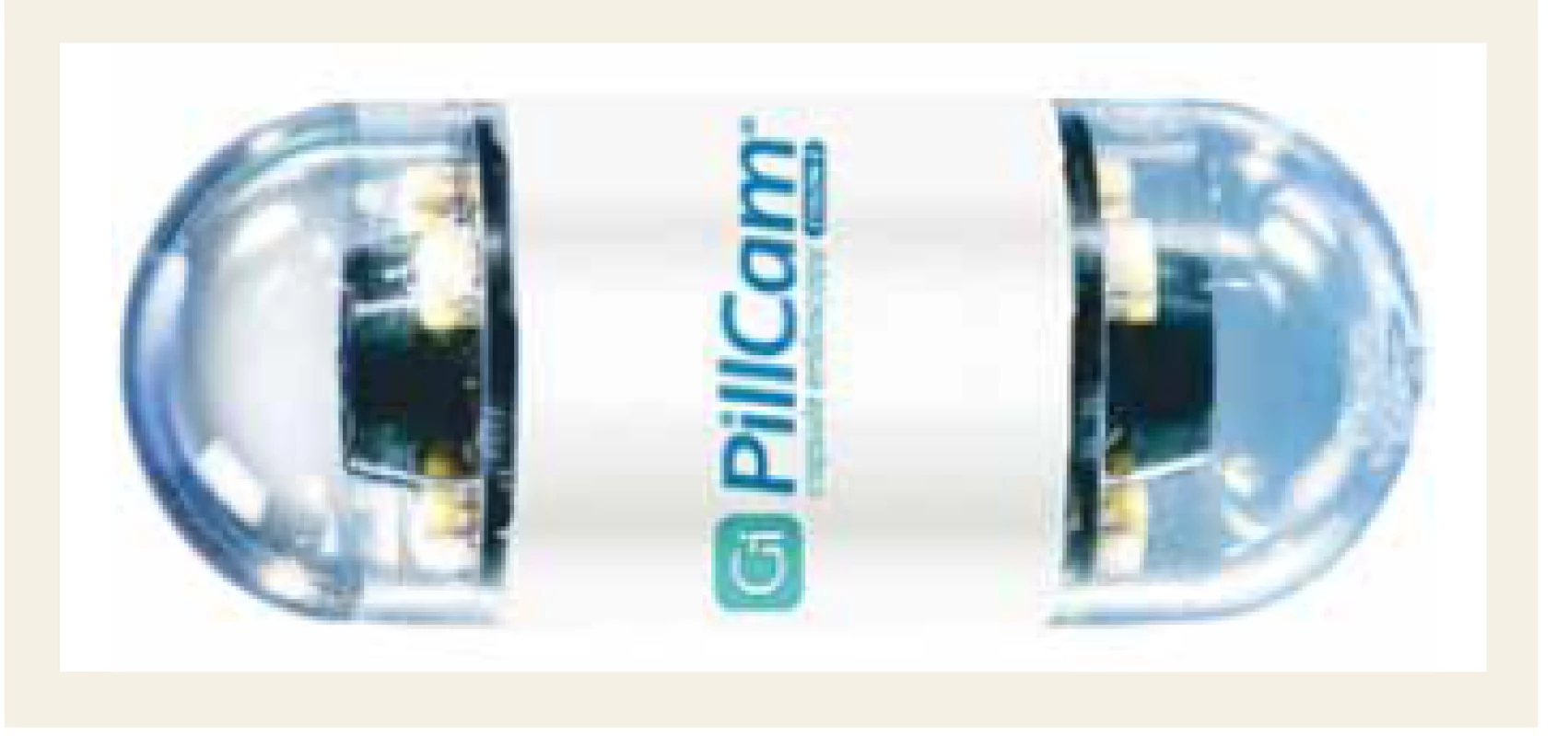 Kolonické kapsle PillCam
COLON 2.<br>
Fig. 1. PillCam COLON 2 colon capsule.