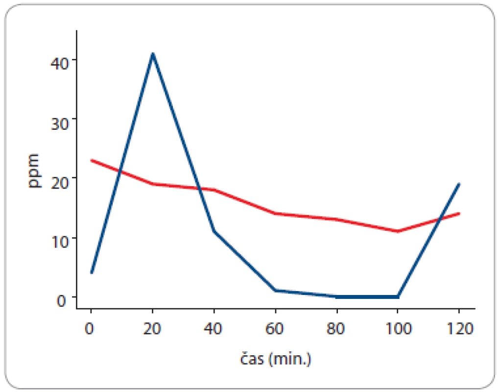 Vodíkový a metanový dechový test u 60letého pacienta,
od roku 2015 léčeného pro liposarkom malé pánve. Opakovaně
došlo k recidivě bakteriálního přerůstání v tenkém střevě. Současně
byla diagnostikována závažná malabsorpce žlučových kyselin
(SeHCAT scan – retence radiofarmaka: 0 % v den 7; norma
> 20 %). Vzestup koncentrace metanu ve vydechovaném vzduchu
je patologický (za 20 minut po perorálním podání 75 g glukózy),
je diagnostický pro syndrom bakteriálního přerůstání
v tenkém střevě (metanogenní fenotyp).