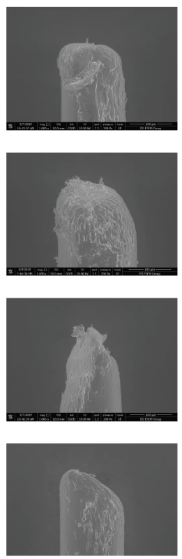 a–3d Variabilita v morfologii
vláken různých zubních
kartáčků zobrazená pomocí
elektronové mikroskopie<br>
(zdroj: archiv
doc. Roubalíkové)<br>
Fig 3a–3d Variability in fiber morphology
of different toothbrushes
imaged by electron microscopy<br>
(source: archives
Assoc. Prof. Roubalíková)